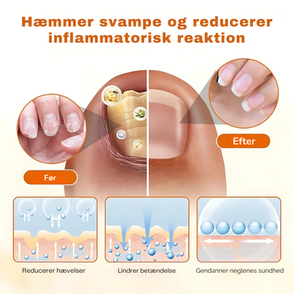 FungiFix™ – Avanceret Svampedræbende Negleplejespray