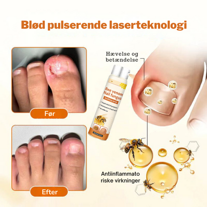 FungiFix™ – Avanceret Svampedræbende Negleplejespray