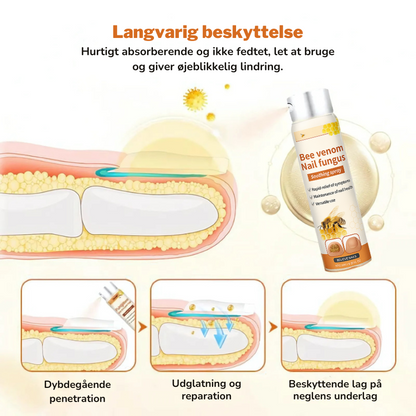 FungiFix™ – Avanceret Svampedræbende Negleplejespray